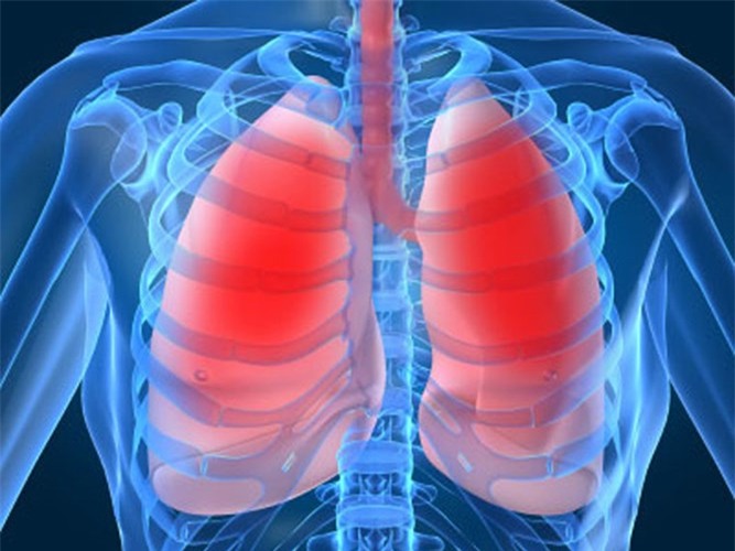 Ung thư phổi: Những nguyên nhân không ngờ - Ảnh 1