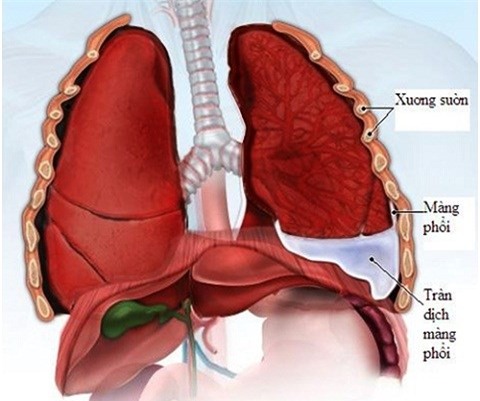 Những triệu chứng phổ biến của ung thư phổi - Ảnh 1